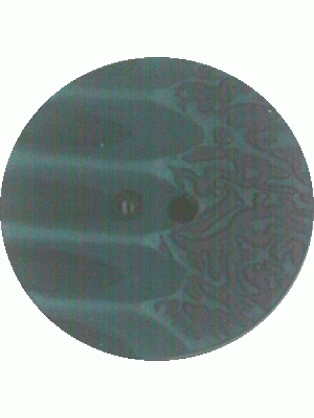 Button 938
